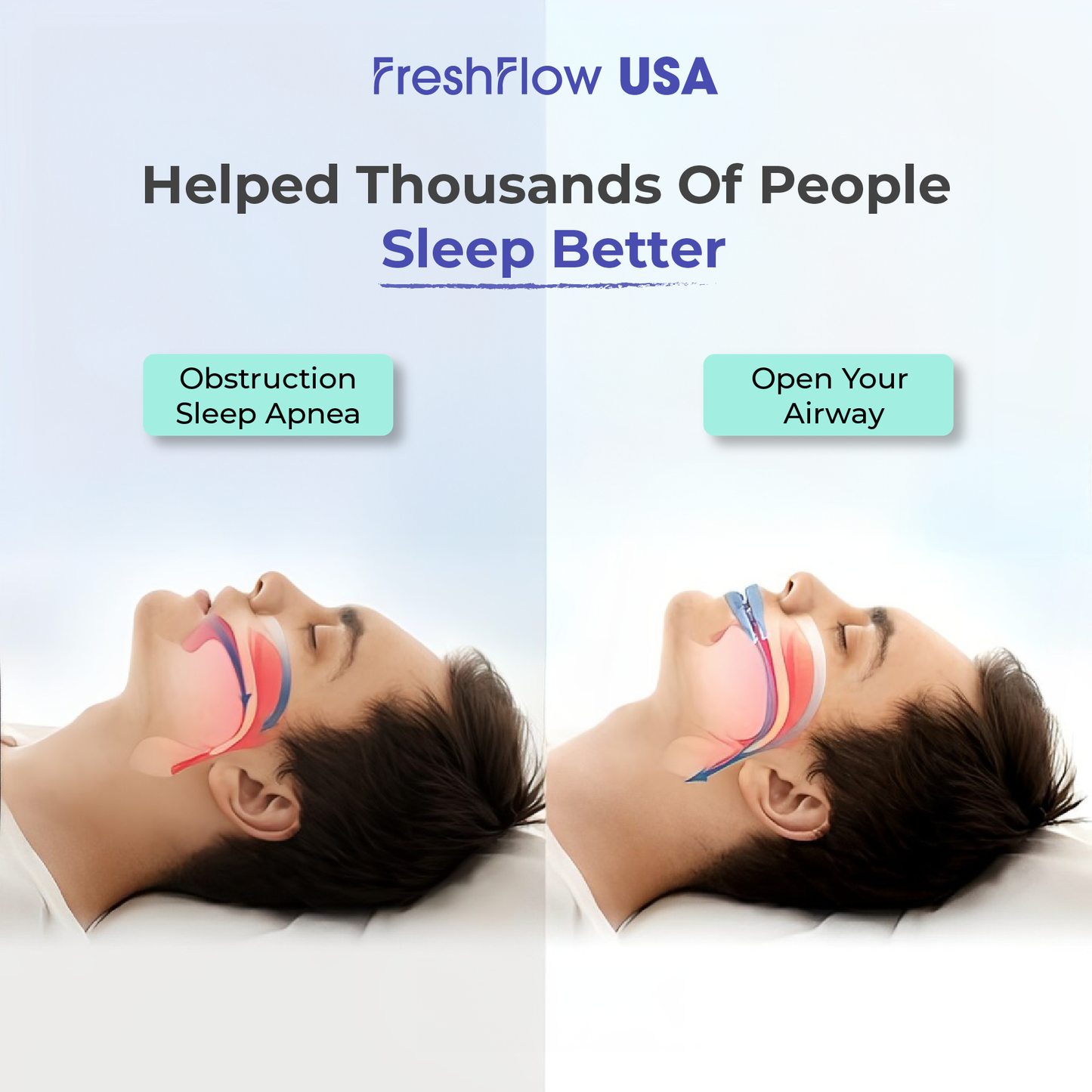 FreshFlow™ USA Anti-Snoring Mouthpiece | Flash Sale