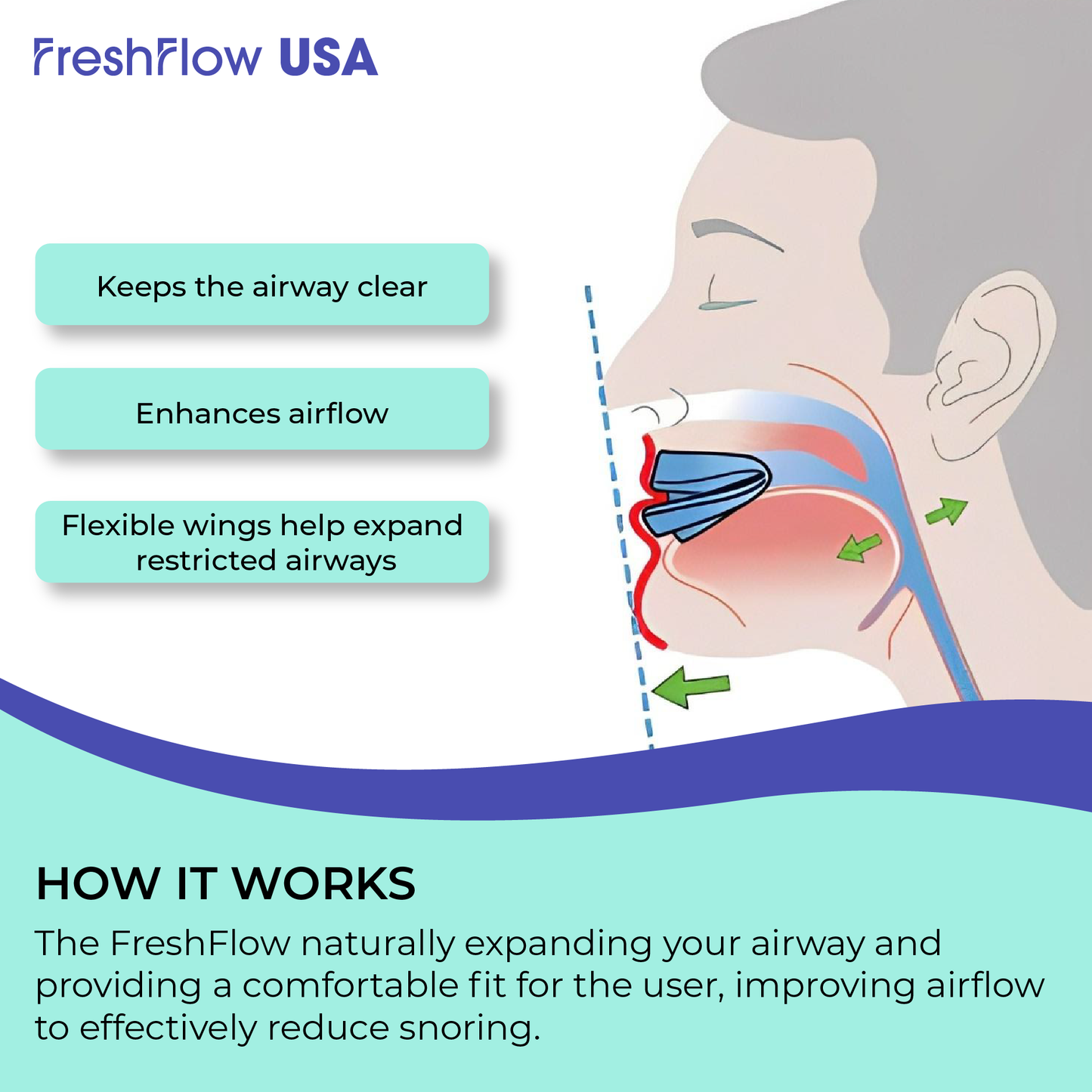 FreshFlow™ USA Anti-Snoring Mouthpiece